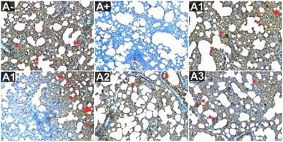 Rhodomyrtus tomentosa (Aiton) Hassk. (haramonting) protects against allethrin-exposed pulmo damage in rats: mechanistic interleukins